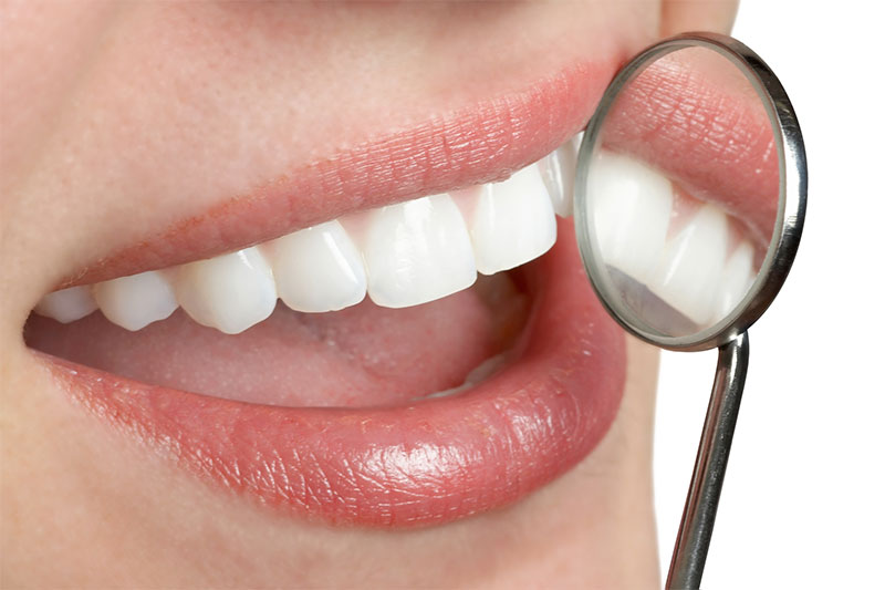 Lynwood Smile Dental Dental Offer